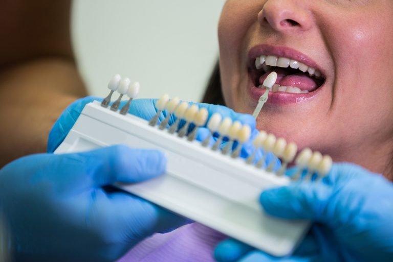 Implantes dentales en Clínica Dental Borrego Cirbián, Puente Genil