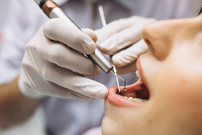 Procedimiento de endodoncia en Clínica Dental Borrego Cirbián